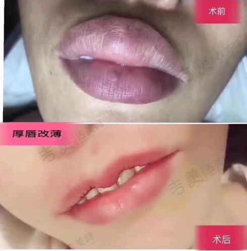 北京嘉禾整形医院眼部整形项目特色