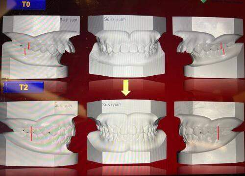 北京嘉禾整形医院的主推项目及价格