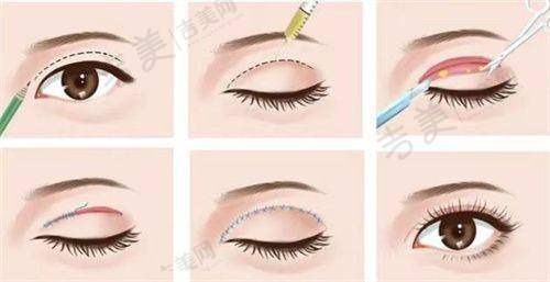 北京嘉禾医疗美容医生团队介绍