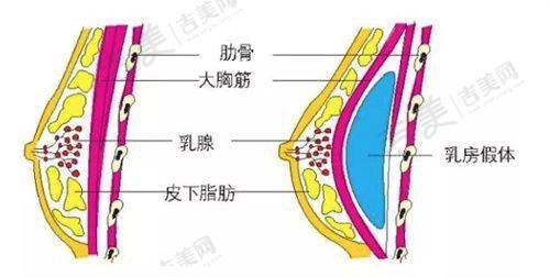 北京嘉禾医疗美容主推眼部整形项目