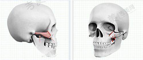北京嘉禾医疗美容总结