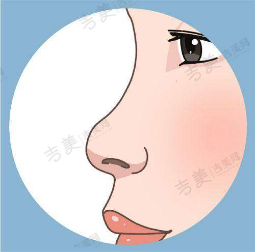 北京嘉禾整形医院的鼻部项目特色