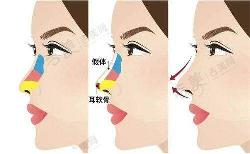 北京嘉禾医疗美容成单更多项目