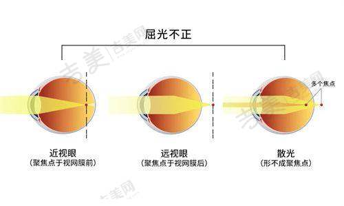 乌鲁木齐普瑞眼科医院手机APP预约方式