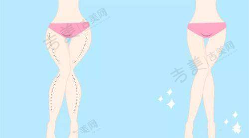 北京嘉禾整形医院不开展的项目有哪些