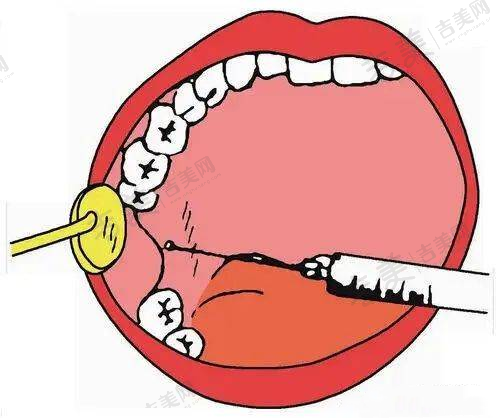 北京嘉禾医疗美容主推鼻部整形项目