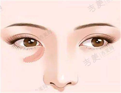 北京嘉禾整形医院的注射与抗衰项目特色