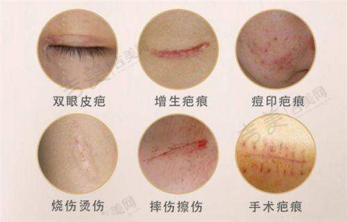 北京嘉禾医疗美容主推脂肪整形项目