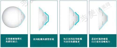 乌鲁木齐普瑞眼科医院诊疗项目与价格参考