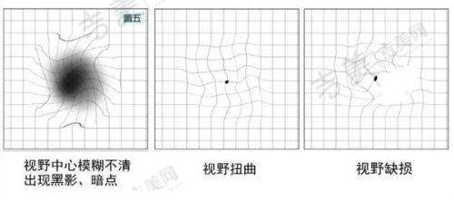 乌鲁木齐普瑞眼科医院电话预约方式