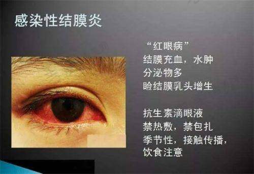 乌鲁木齐普瑞眼科医院预约注意事项