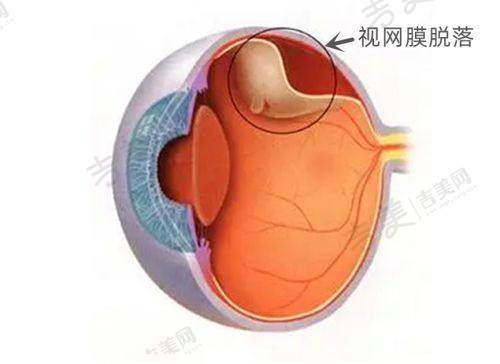 浙江大学医学校附属第二医院眼科国内十大眼科医院排行榜情况