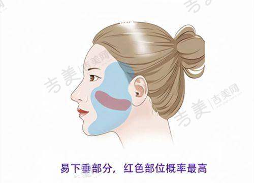 北京嘉禾整形医院无创注射项目特色