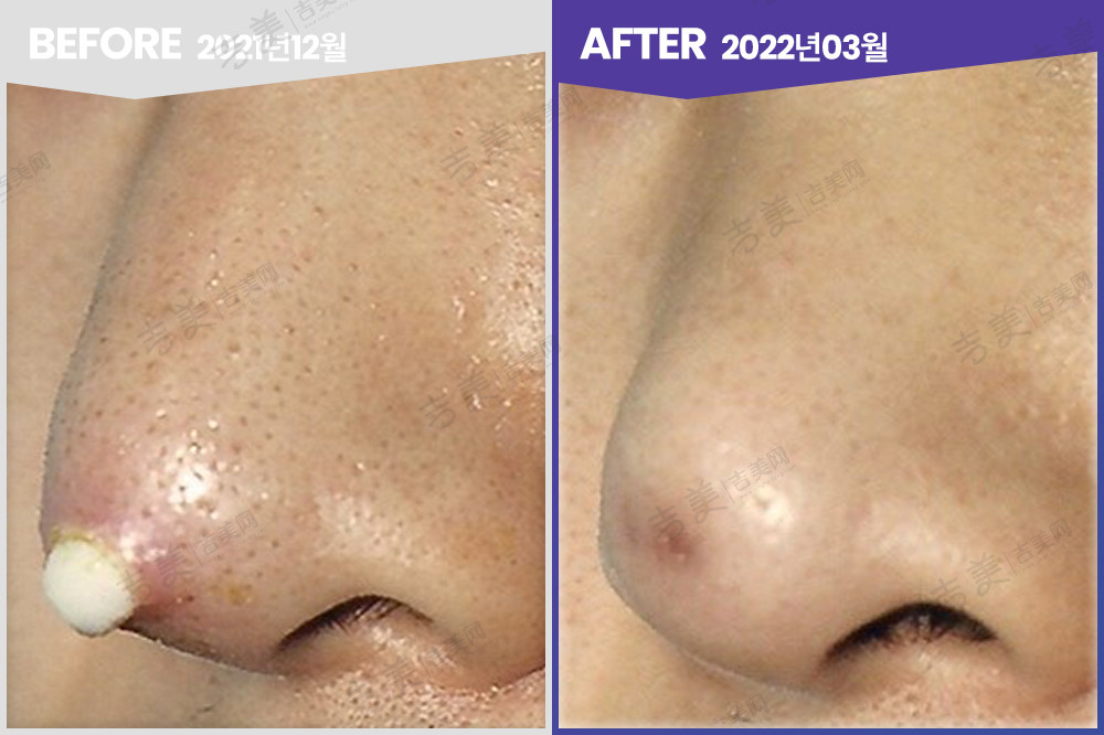 韩国宝尼达整形外科环境图