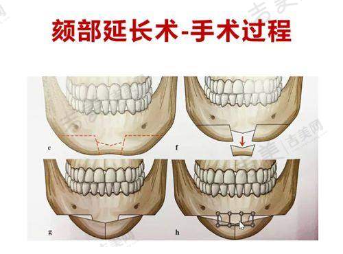 深圳八大处整形的收费是否合理