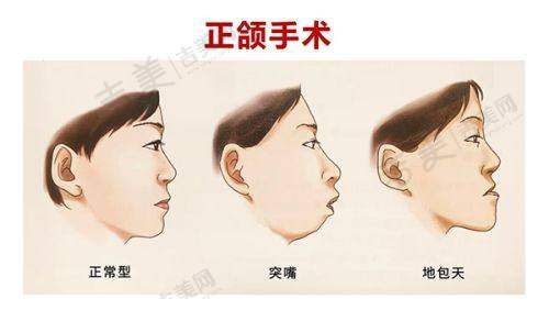 深圳八大处整形的口碑评价怎么样