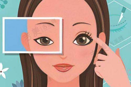 深圳卫尔斯眼科门诊部收费不贵且正规顾客好评