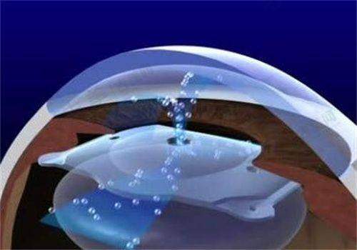 上海爱尔眼科医院特色亮点