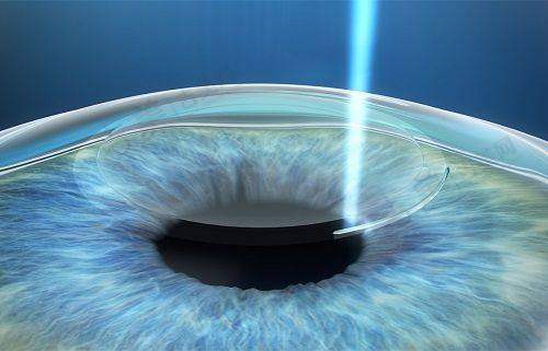 上海眼科医院的技术发展与未来趋势