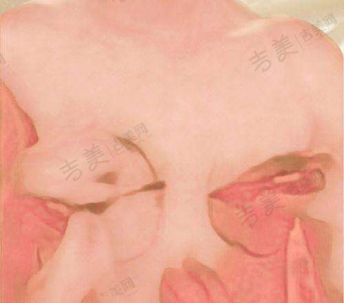 深圳八大处整形医院的实力医生团队