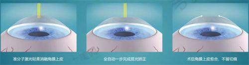 上海眼科医院的预约与服务体验