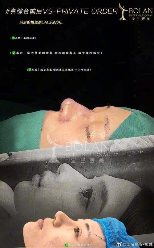 深圳八大处整形询问可了解的项目