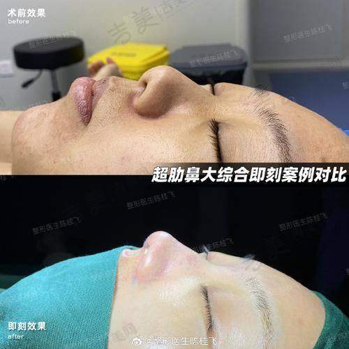 深圳八大处整形询问的注意事项