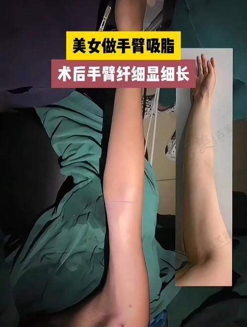 深圳八大处整形正规靠谱吗?技术是核心保护