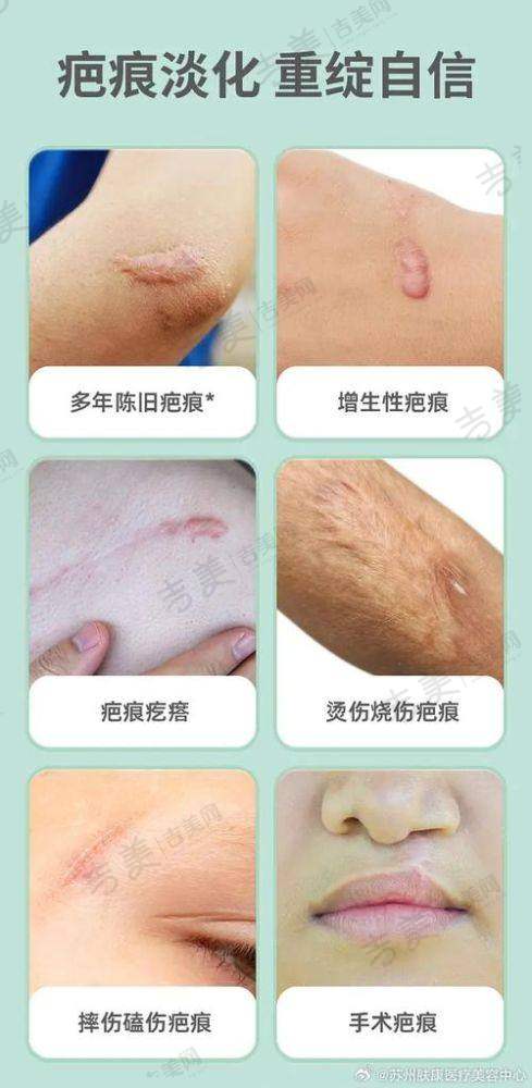 深圳八大处整形可靠吗?合理价格透明消费