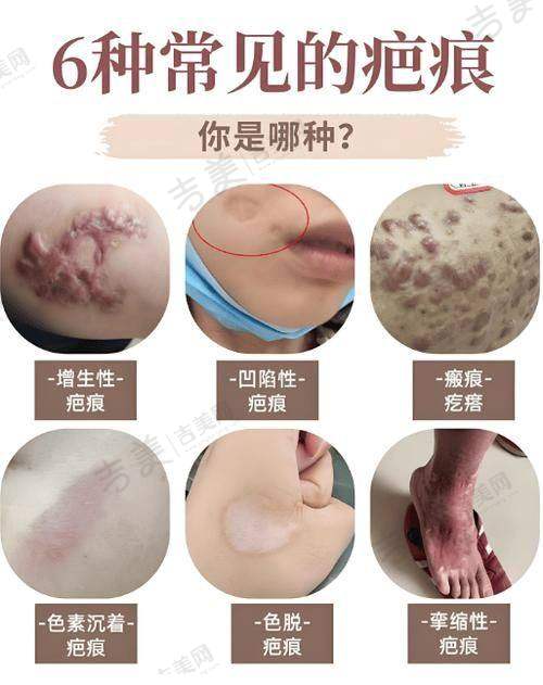 深圳八大处整形可靠吗?丰富项目经验支撑