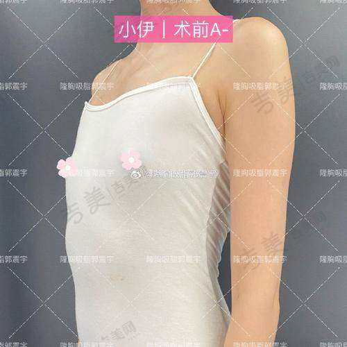 深圳八大处整形询问医生推荐