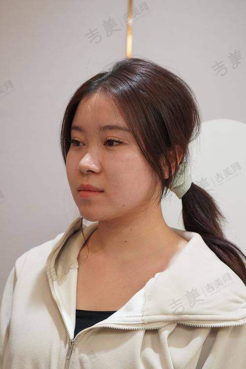 深圳八大处整形询问的价格优势