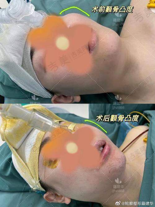 深圳八大处整形如何预约